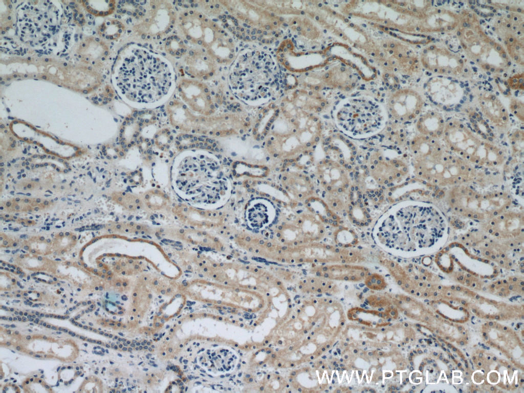 IHC staining of human kidney using 21582-1-AP