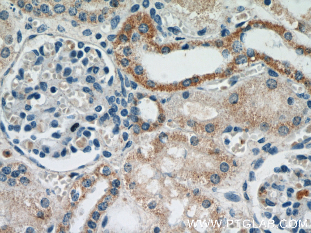 IHC staining of human kidney using 21582-1-AP