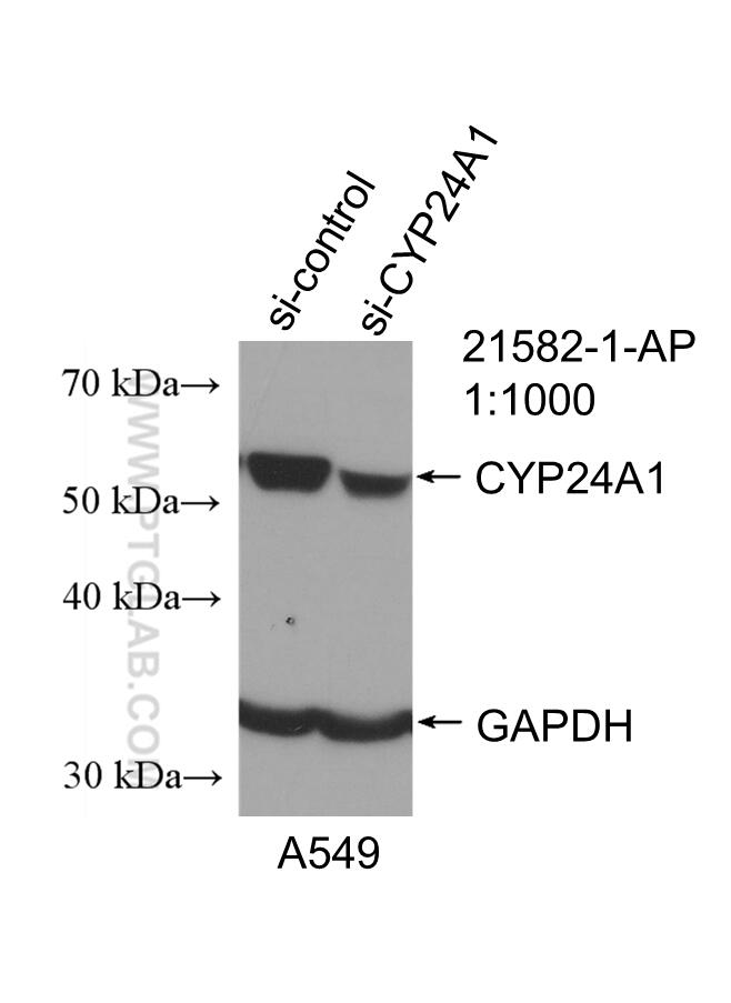 WB analysis of A549 using 21582-1-AP