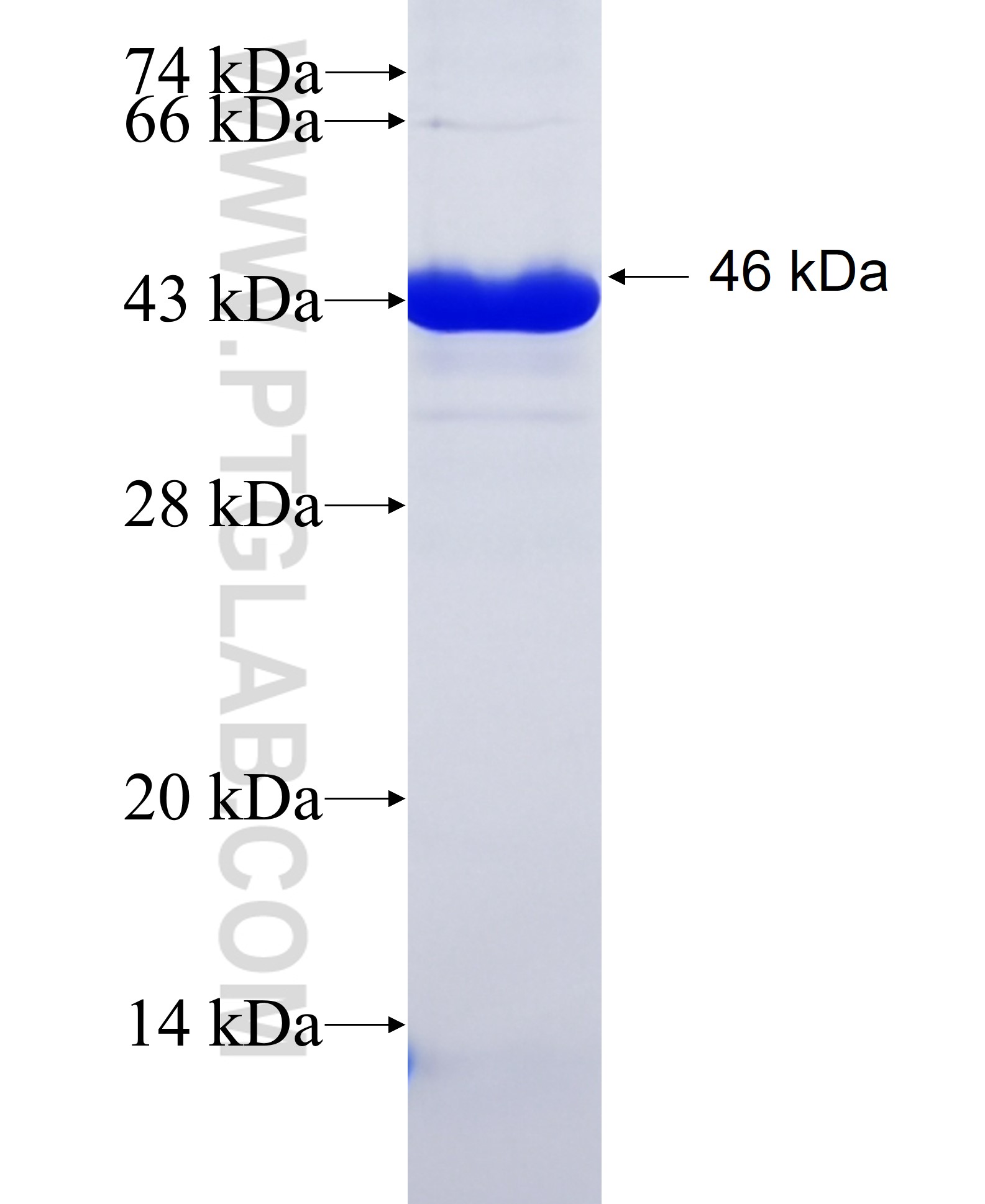 CYP24A1 fusion protein Ag17089 SDS-PAGE