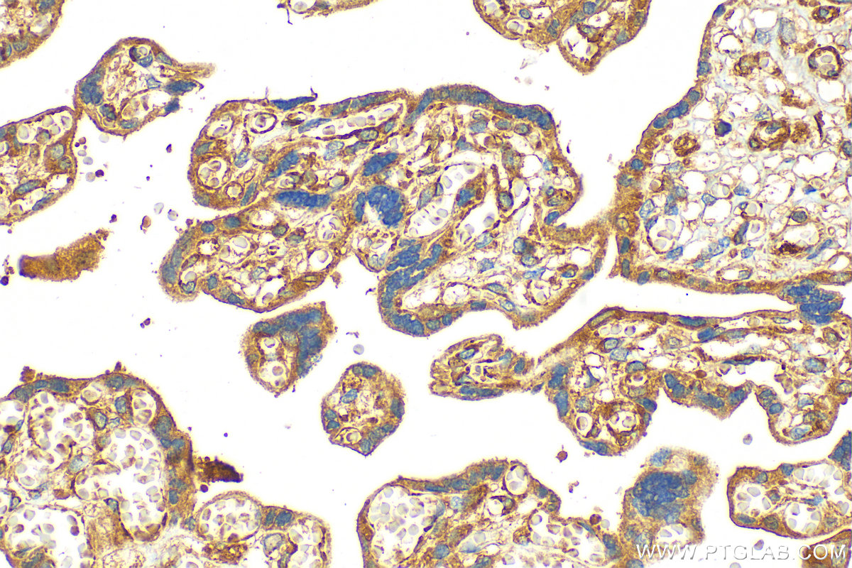 IHC staining of human placenta using 28081-1-AP