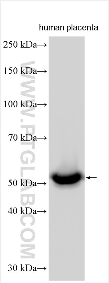 WB analysis using 28081-1-AP