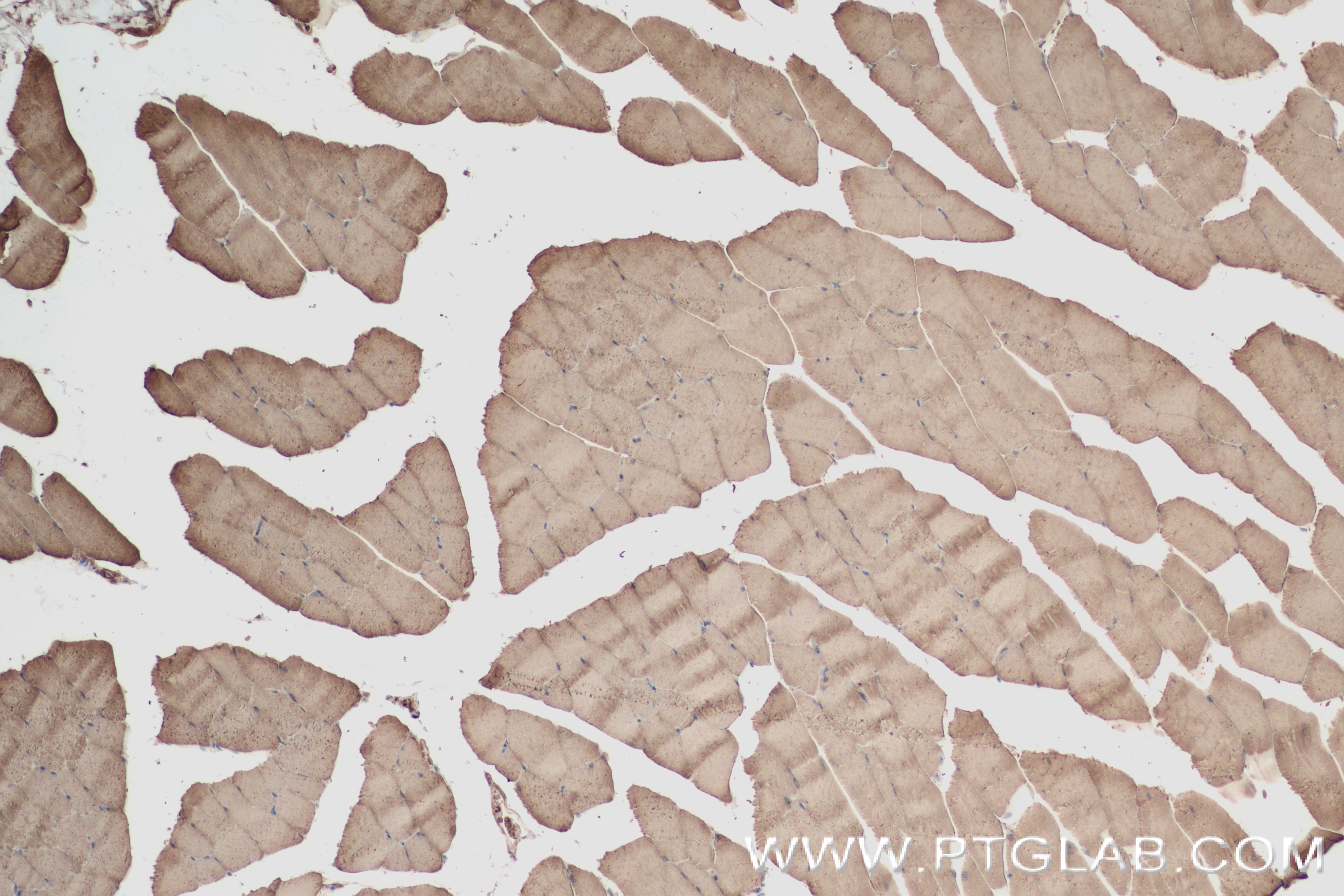 IHC staining of mouse skeletal muscle using 84699-1-RR (same clone as 84699-1-PBS)