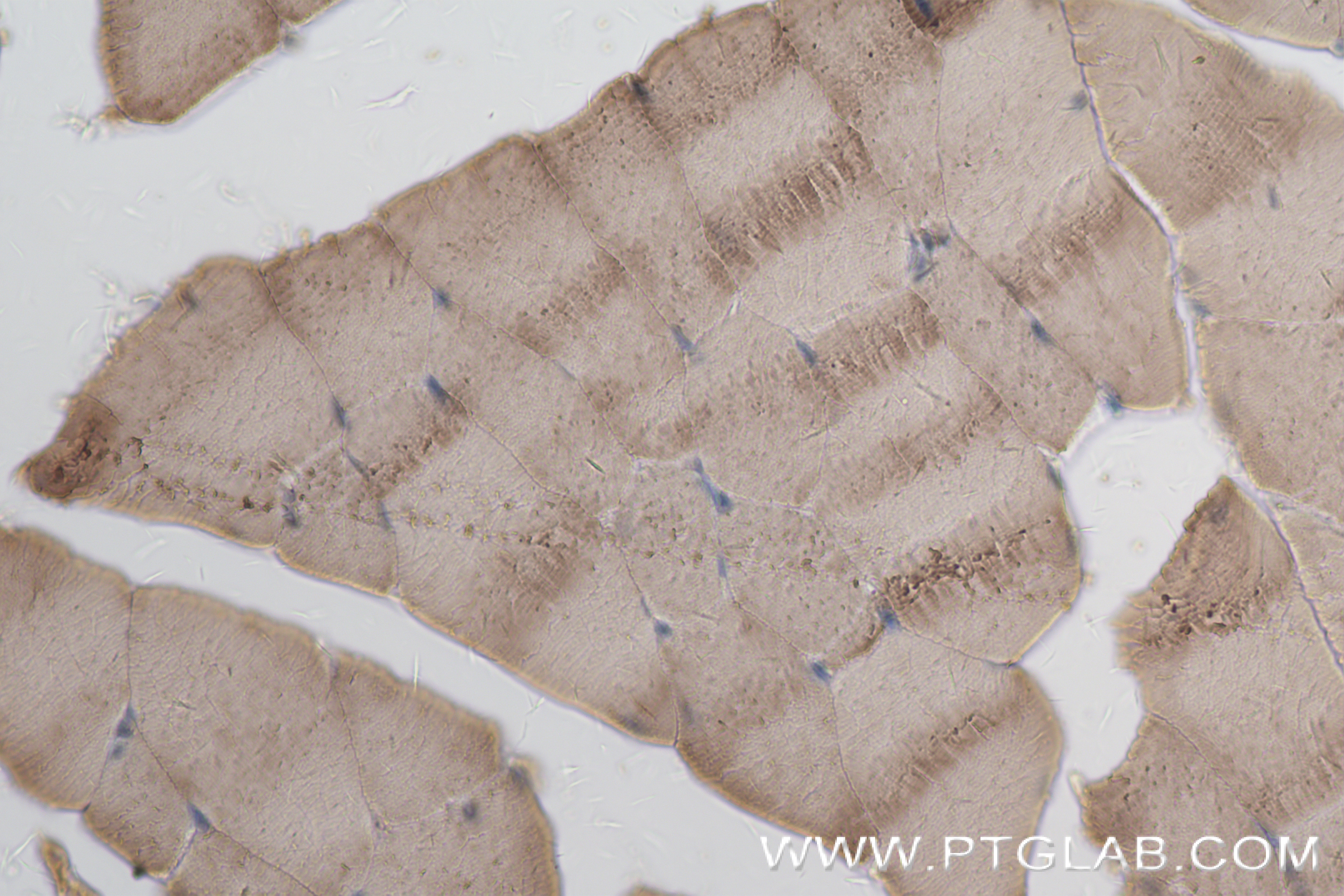 IHC staining of mouse skeletal muscle using 84699-1-RR (same clone as 84699-1-PBS)