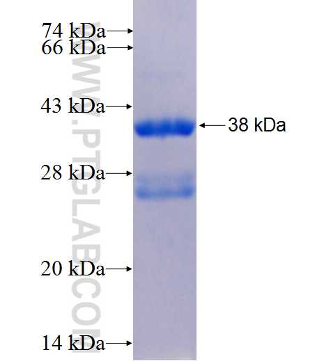 CYP26A1 fusion protein Ag24898 SDS-PAGE