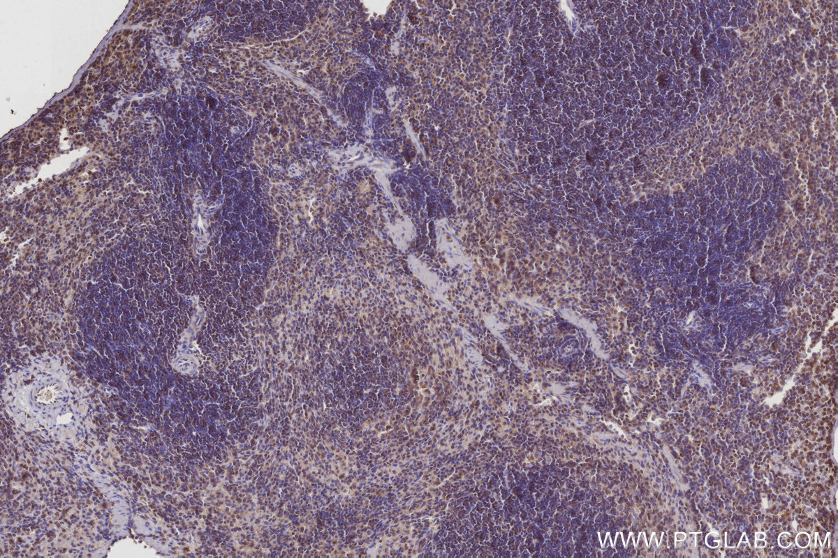 IHC staining of mouse spleen using 21555-1-AP IHC staining of mouse spleen using 21555-1-AP