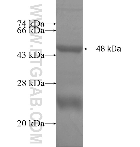 CYP26B1 fusion protein Ag15368 SDS-PAGE