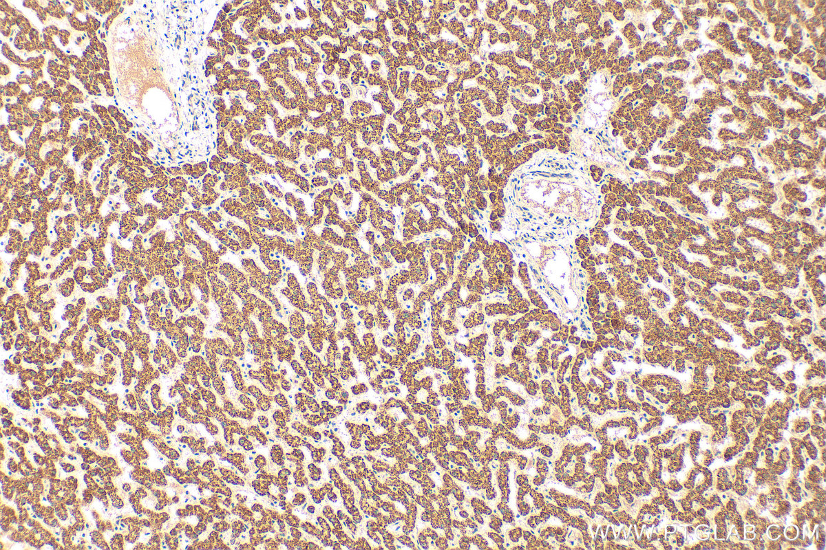 Immunohistochemical analysis of paraffin-embedded human liver tissue slide using 14739-1-AP (CYP27A1 antibody) at dilution of 1:200 (under 10x lens). Heat mediated antigen retrieval with Tris-EDTA buffer (pH 9.0). IHC staining of human liver using 14739-1-AP