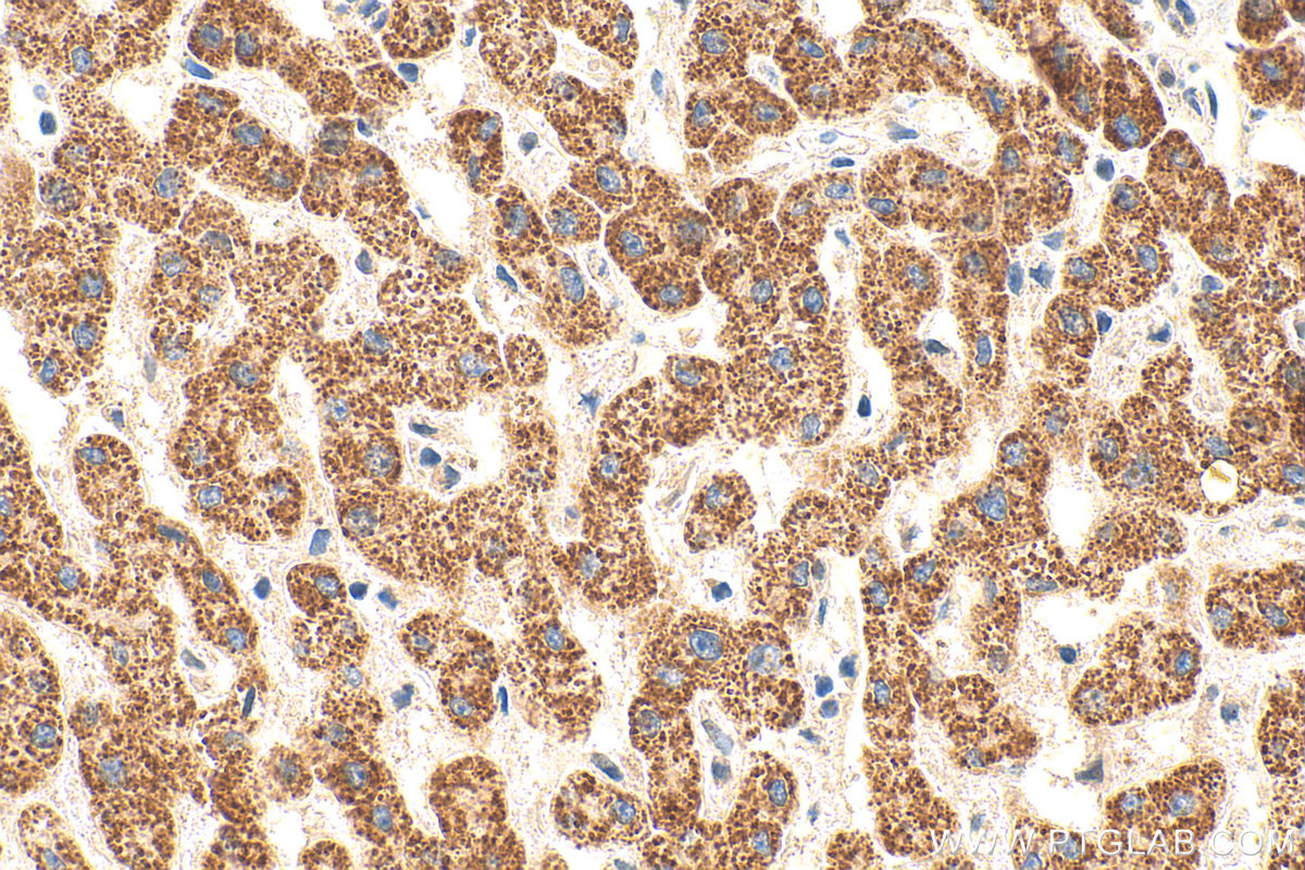 Immunohistochemical analysis of paraffin-embedded human liver tissue slide using 14739-1-AP (CYP27A1 antibody) at dilution of 1:200 (under 40x lens). Heat mediated antigen retrieval with Tris-EDTA buffer (pH 9.0). IHC staining of human liver using 14739-1-AP