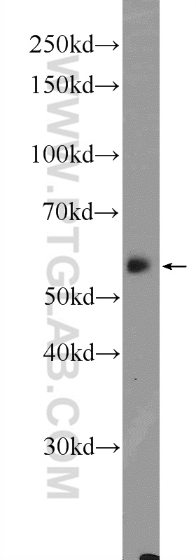 WB analysis of mouse liver using 14739-1-AP