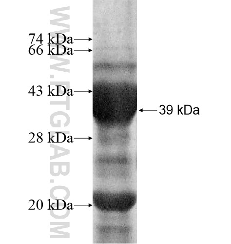 CYP2B7P1 fusion protein Ag11618 SDS-PAGE CYP2B7P1 fusion protein Ag11618 SDS-PAGE