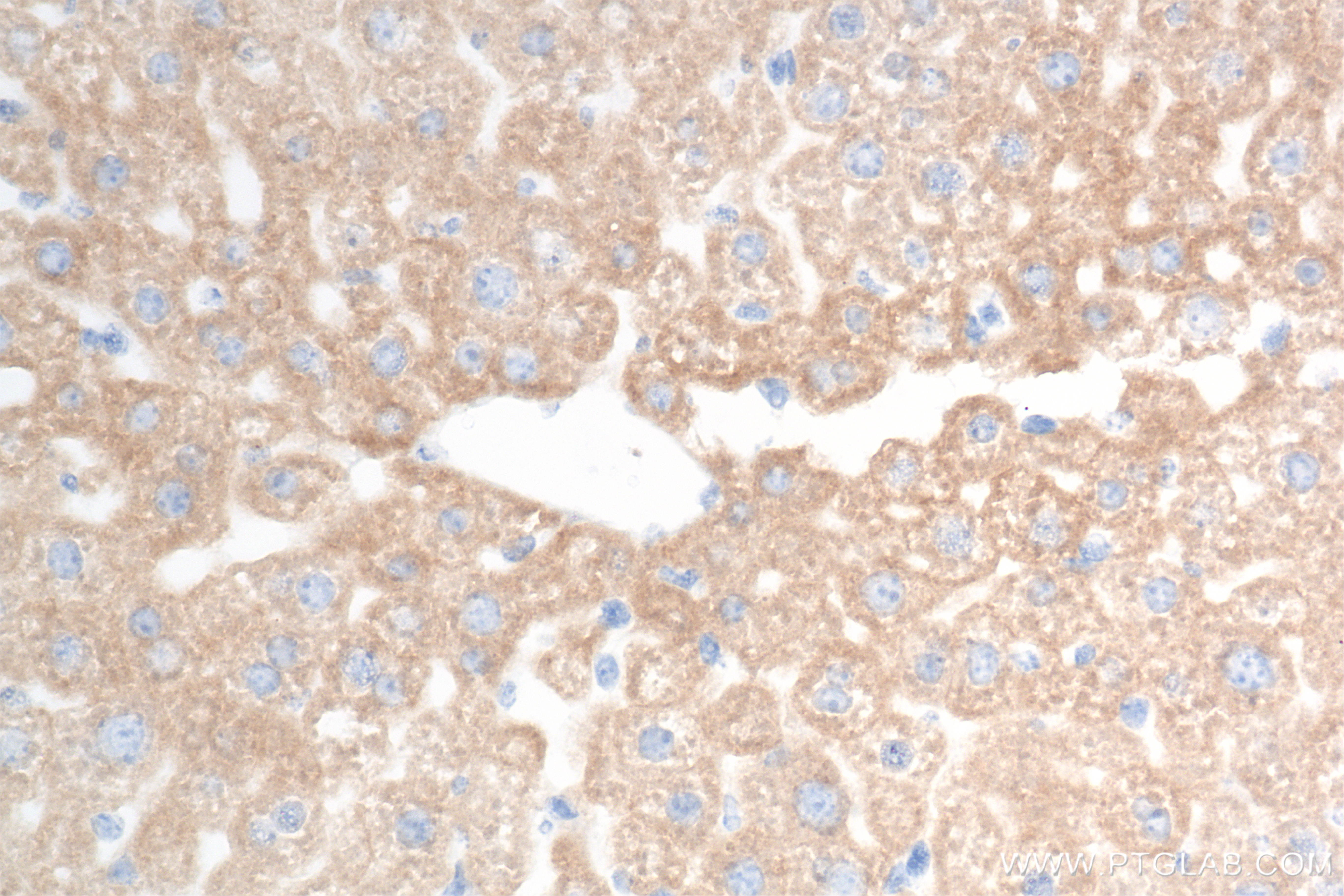 IHC staining of mouse liver using 85717-1-RR