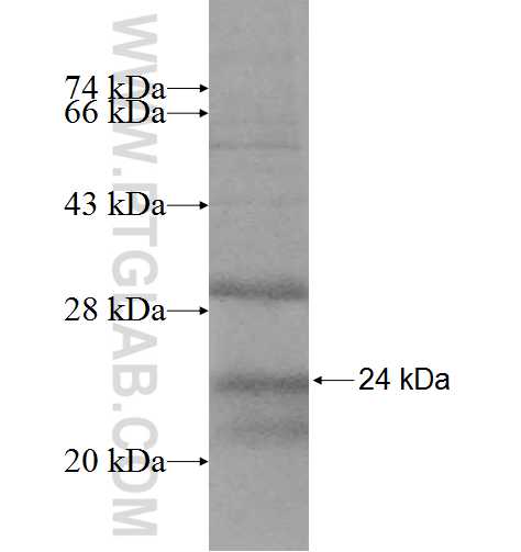 CYP2C9 fusion protein Ag9881 SDS-PAGE CYP2C9 fusion protein Ag9881 SDS-PAGE
