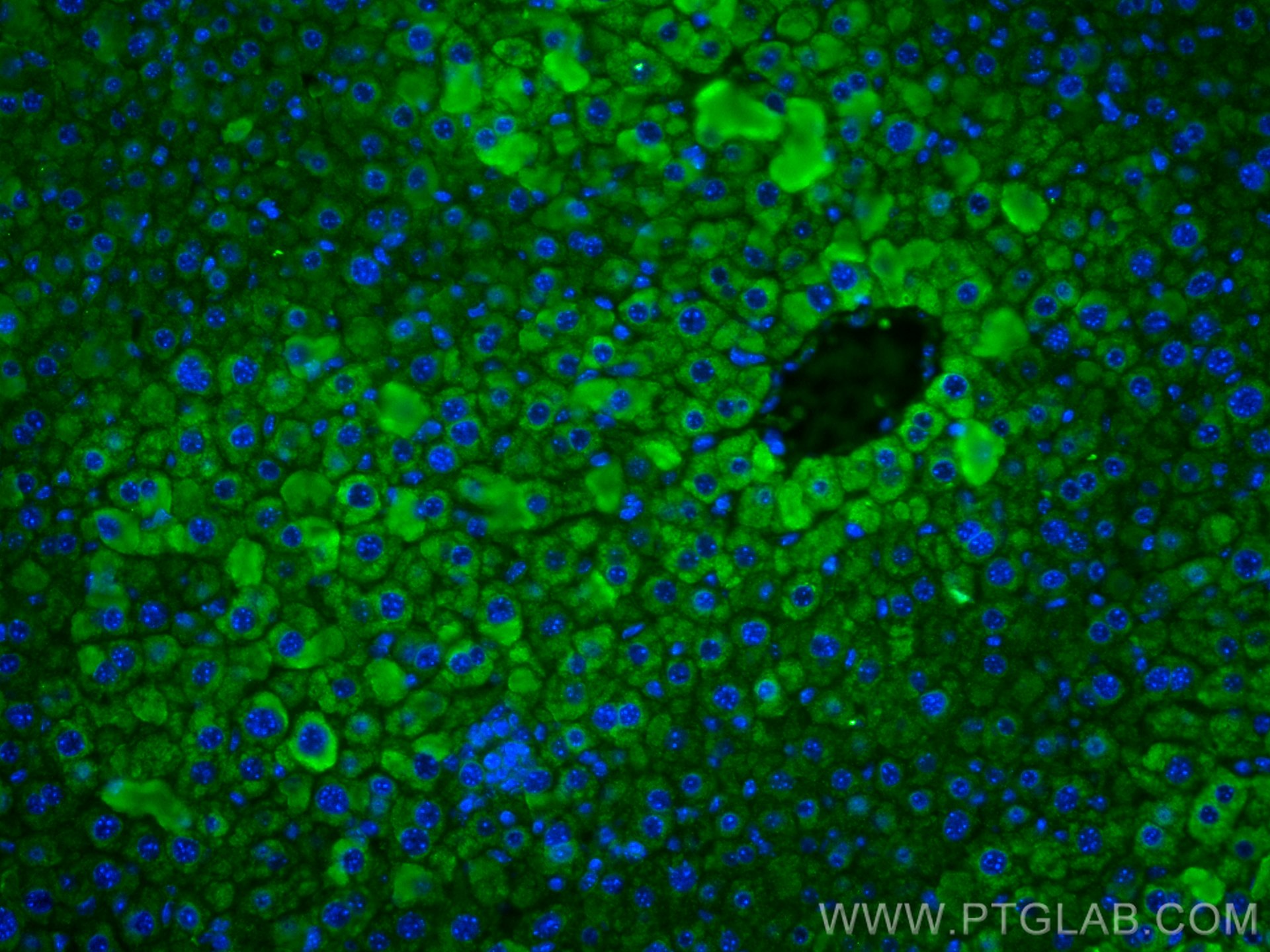 IF Staining of mouse liver using 67263-1-Ig