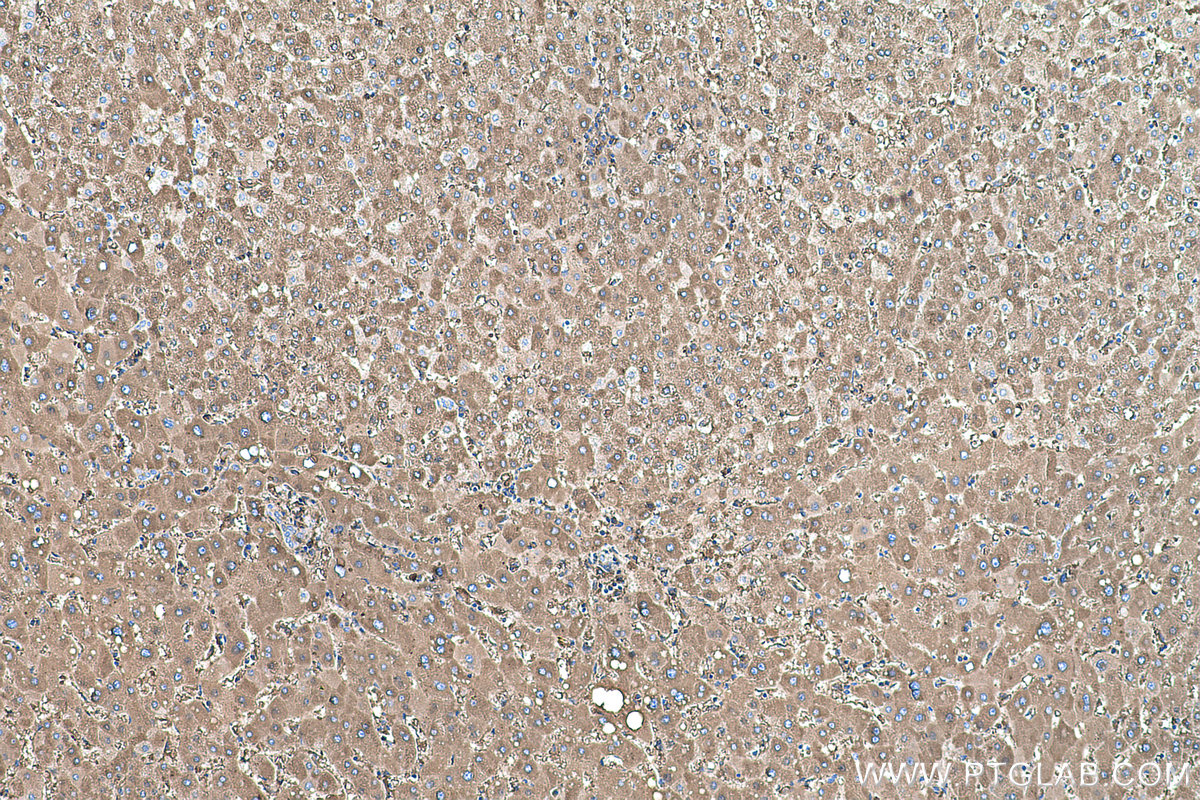 IHC staining of human liver using 67263-1-Ig