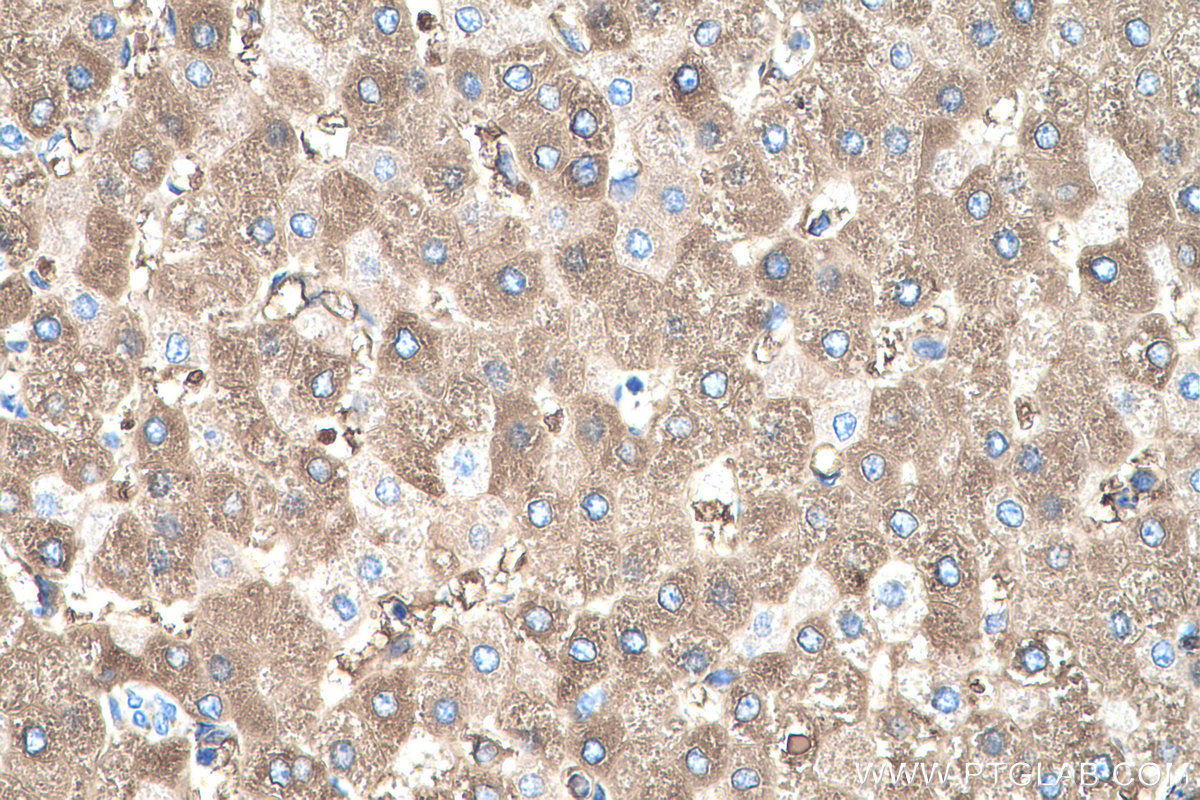 IHC staining of human liver using 67263-1-Ig