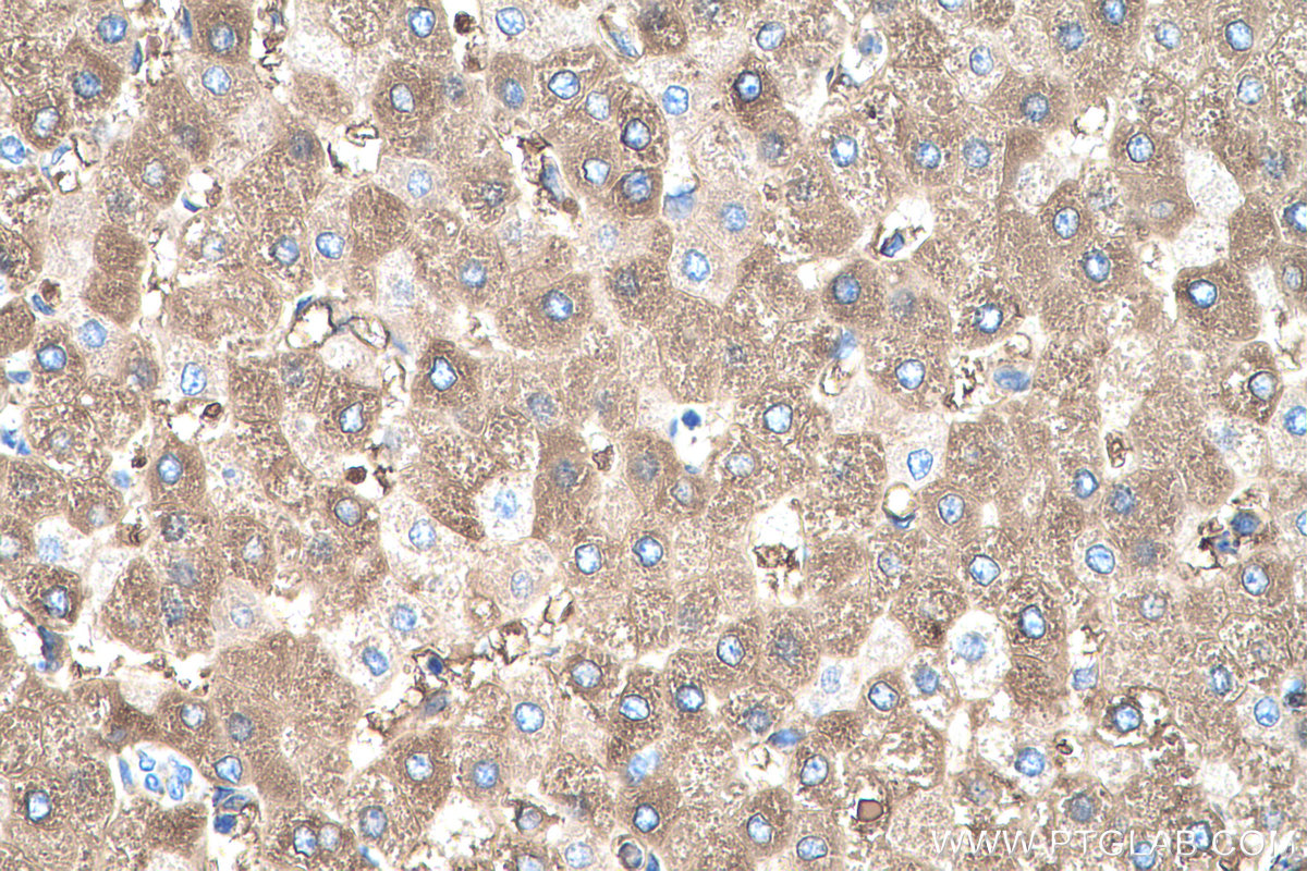 IHC staining of human liver using 67263-1-Ig (same clone as 67263-1-PBS)