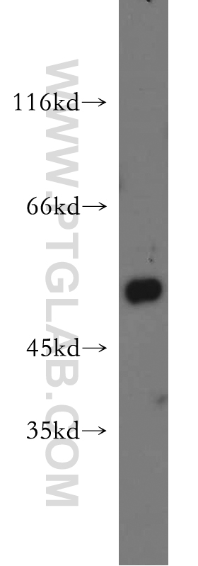 WB analysis of mouse lung using 21579-1-AP