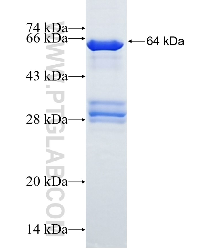 CYP2J2 fusion protein Ag4435 SDS-PAGE