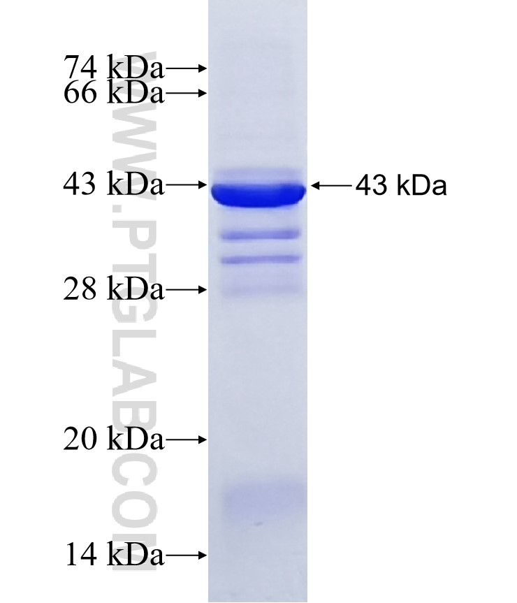 CYP2R1 fusion protein Ag12895 SDS-PAGE CYP2R1 fusion protein Ag12895 SDS-PAGE