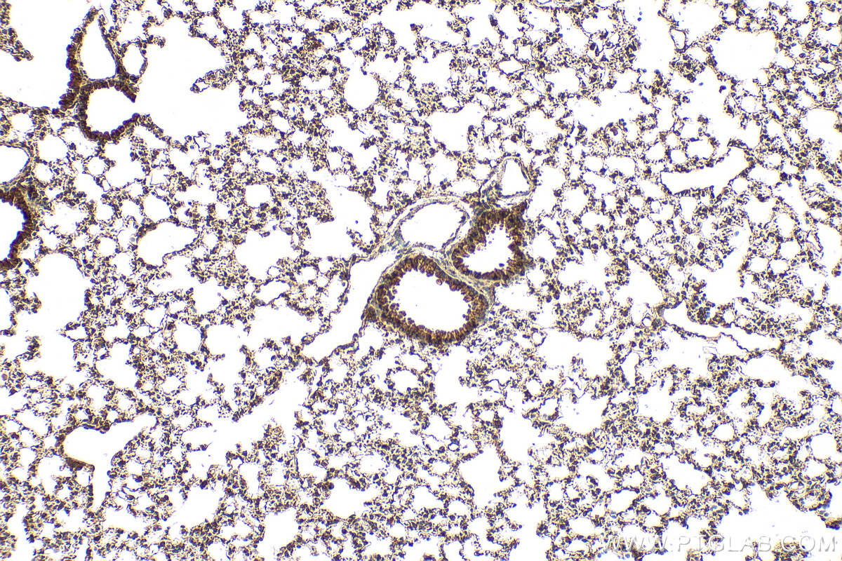Immunohistochemical analysis of paraffin-embedded mouse lung tissue slide using 13654-1-AP (CYP2S1 antibody) at dilution of 1:200 (under 10x lens). Heat mediated antigen retrieval with Tris-EDTA buffer (pH 9.0). IHC staining of mouse lung using 13654-1-AP