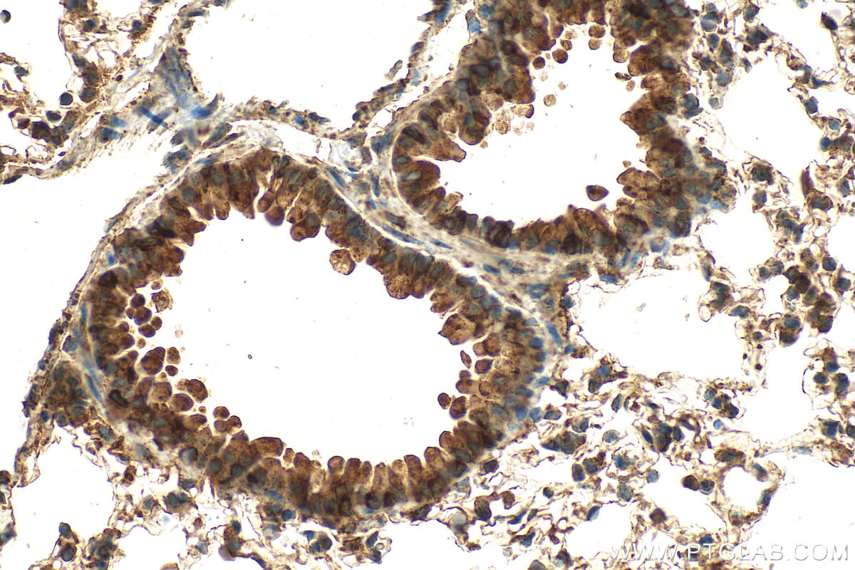 Immunohistochemical analysis of paraffin-embedded mouse lung tissue slide using 13654-1-AP (CYP2S1 antibody) at dilution of 1:200 (under 40x lens). Heat mediated antigen retrieval with Tris-EDTA buffer (pH 9.0). IHC staining of mouse lung using 13654-1-AP