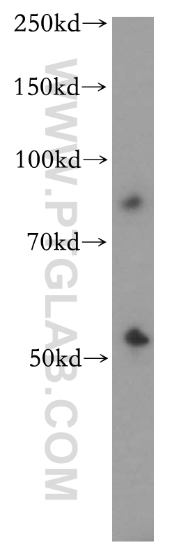 WB analysis of mouse lung using 13654-1-AP