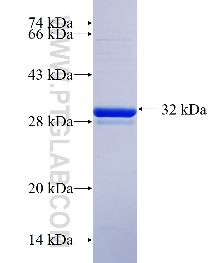 CYP2U1 fusion protein Ag24314 SDS-PAGE CYP2U1 fusion protein Ag24314 SDS-PAGE