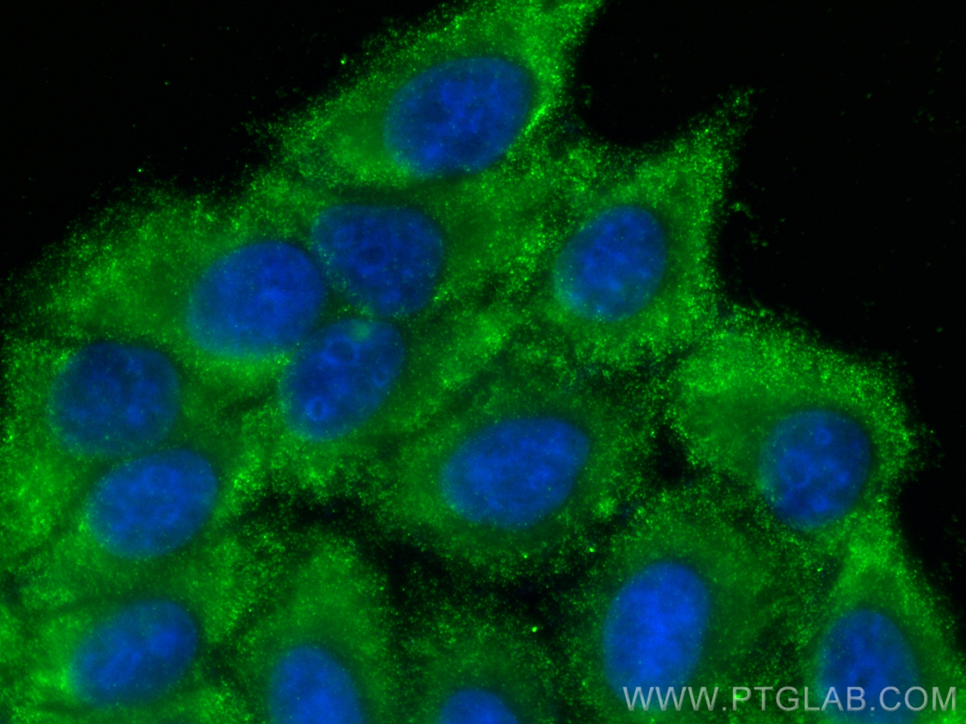 IF Staining of HepG2 using 67110-1-Ig (same clone as 67110-1-PBS)