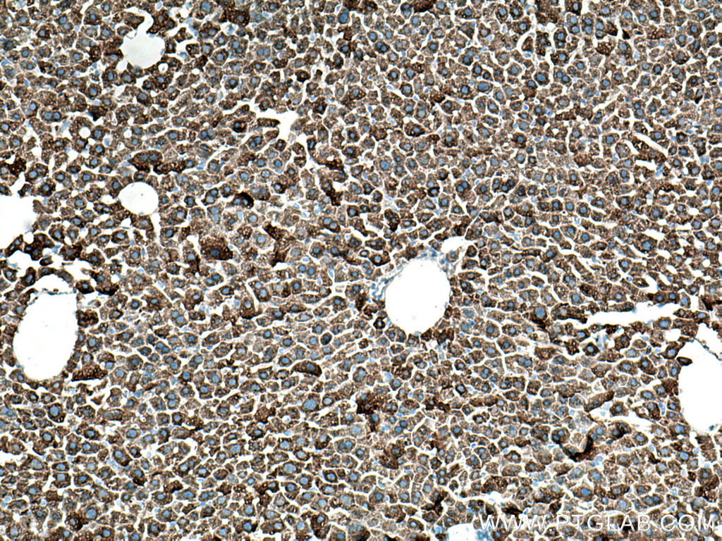 IHC staining of mouse liver using 67110-1-Ig (same clone as 67110-1-PBS)