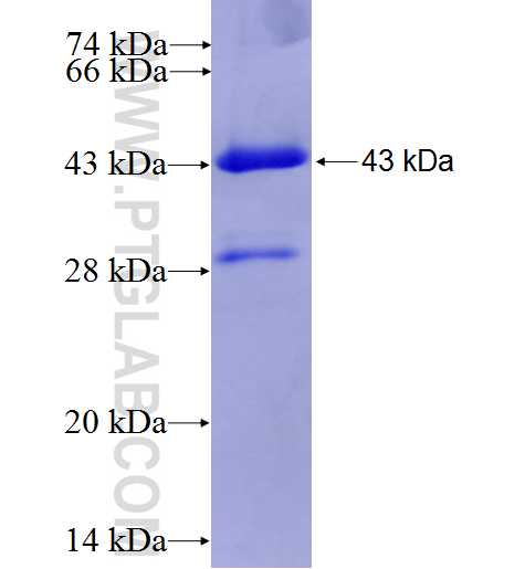 CYP3A5 fusion protein Ag6991 SDS-PAGE