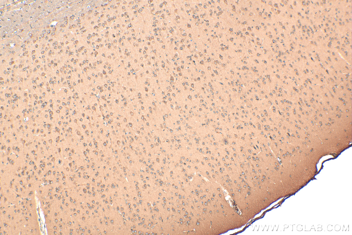 IHC staining of mouse brain using 68576-1-Ig