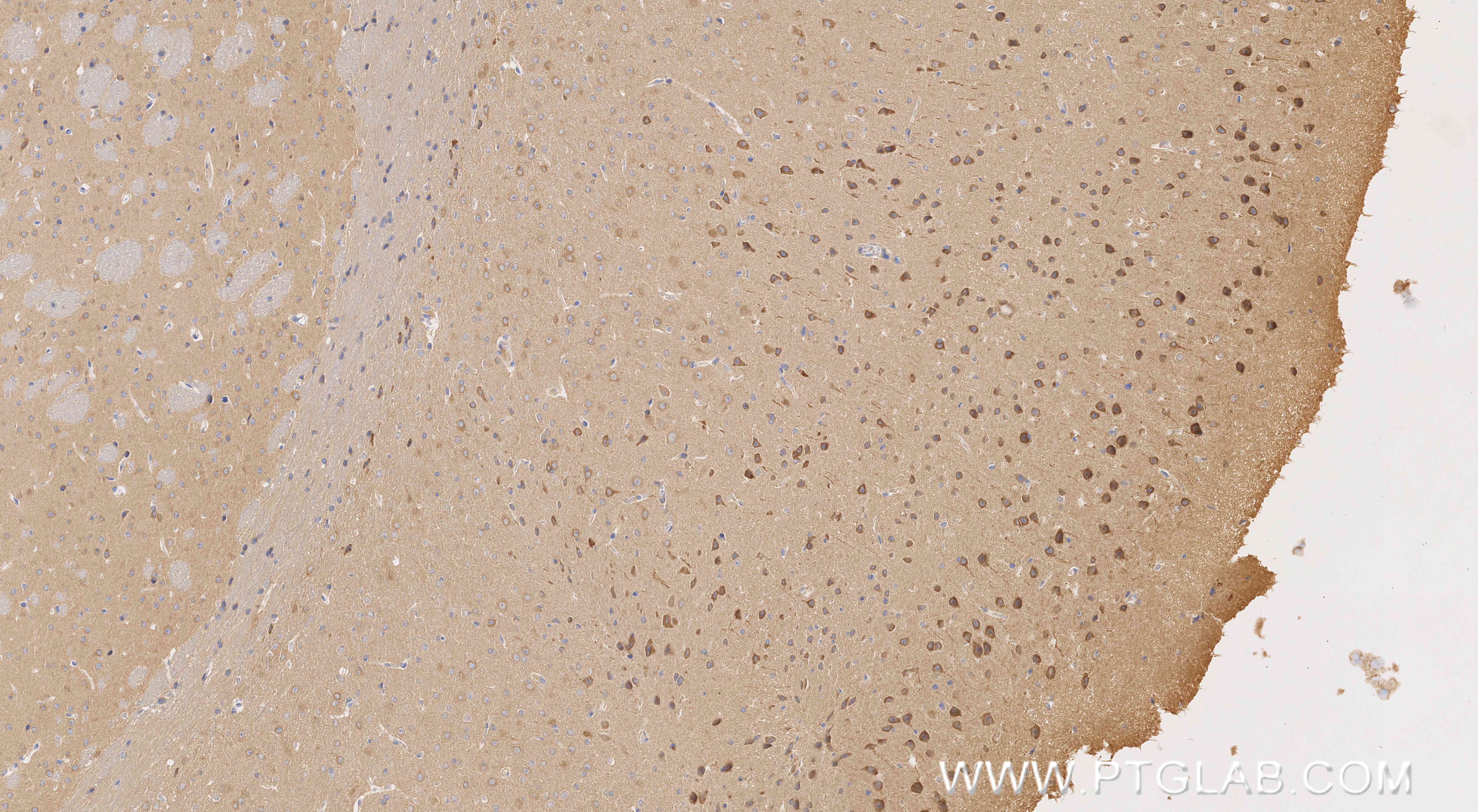 IHC staining of mouse brain using 86957-1-RR (same clone as 86957-1-PBS)
