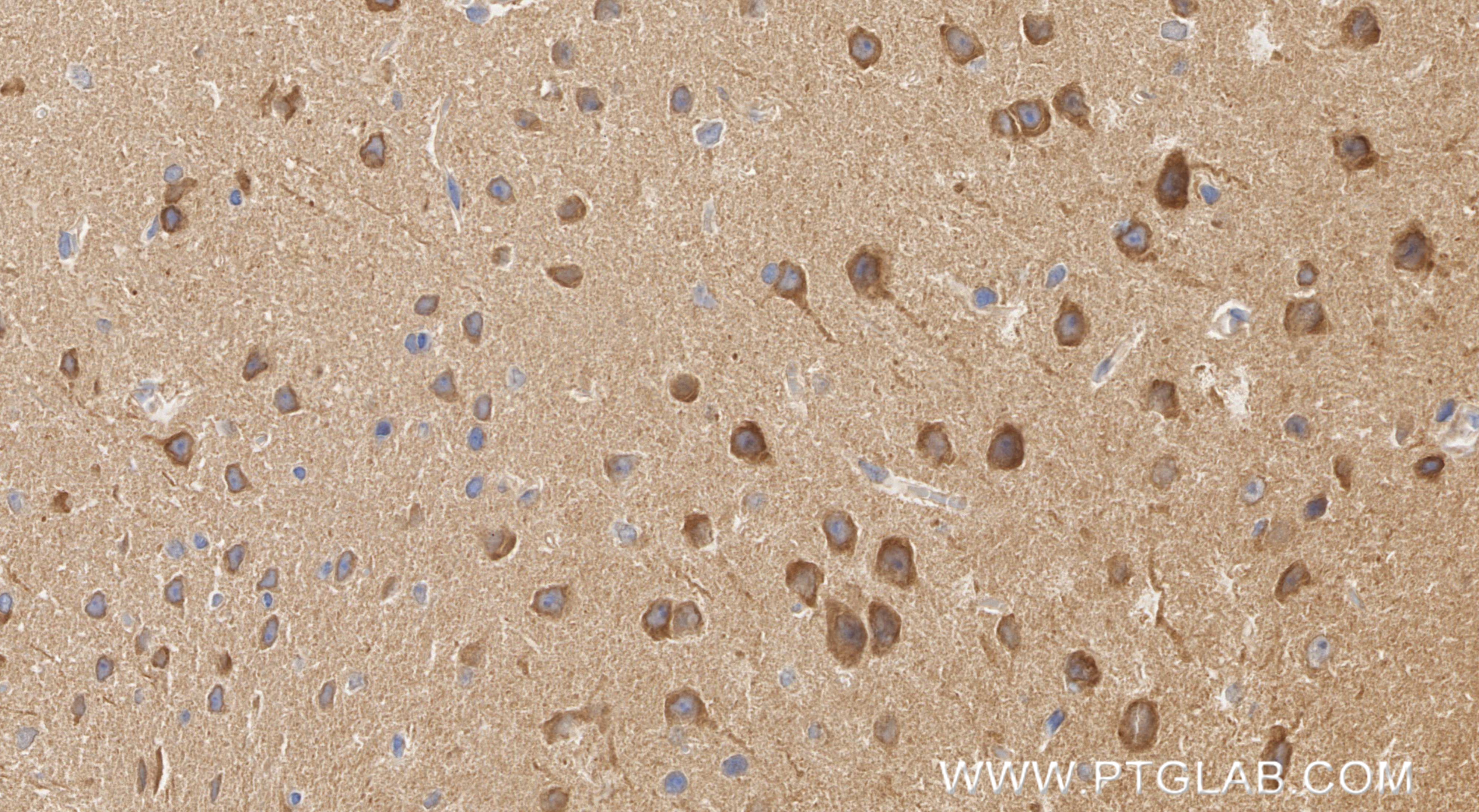 IHC staining of mouse brain using 86957-1-RR (same clone as 86957-1-PBS)