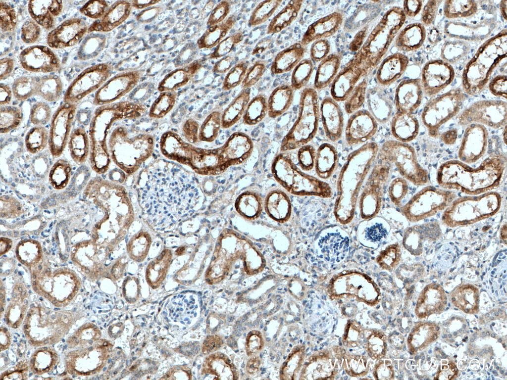 IHC staining of human kidney using 11688-1-AP