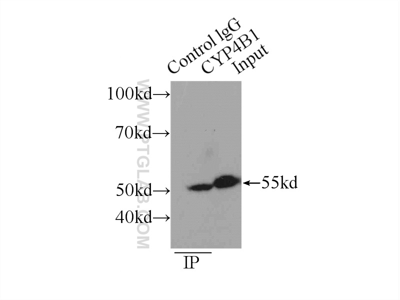 IP experiment of mouse lung using 11771-1-AP