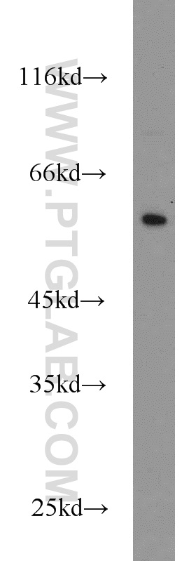 WB analysis of human placenta using 13243-1-AP