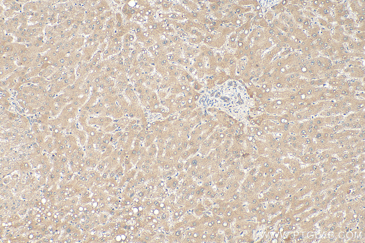 CYP4F2-Specific