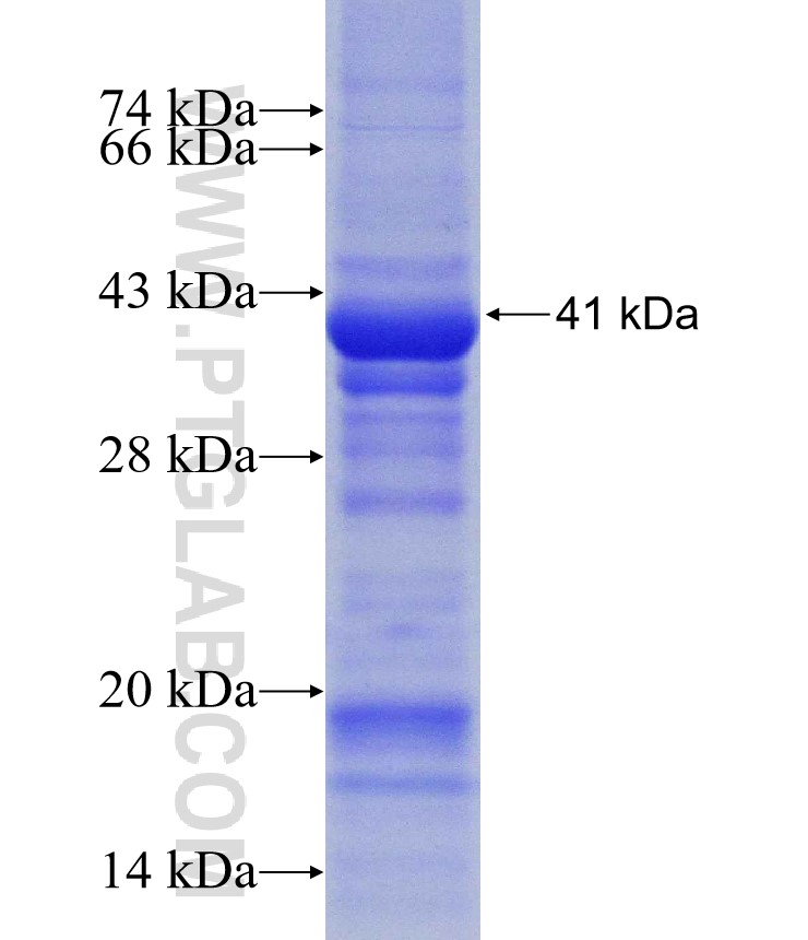 CYP4V2 fusion protein Ag31002 SDS-PAGE