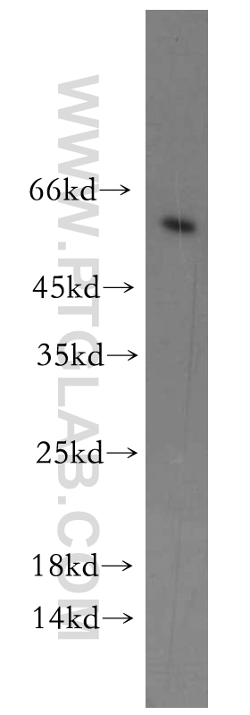 WB analysis of MDA-MB-453s using 20142-1-AP