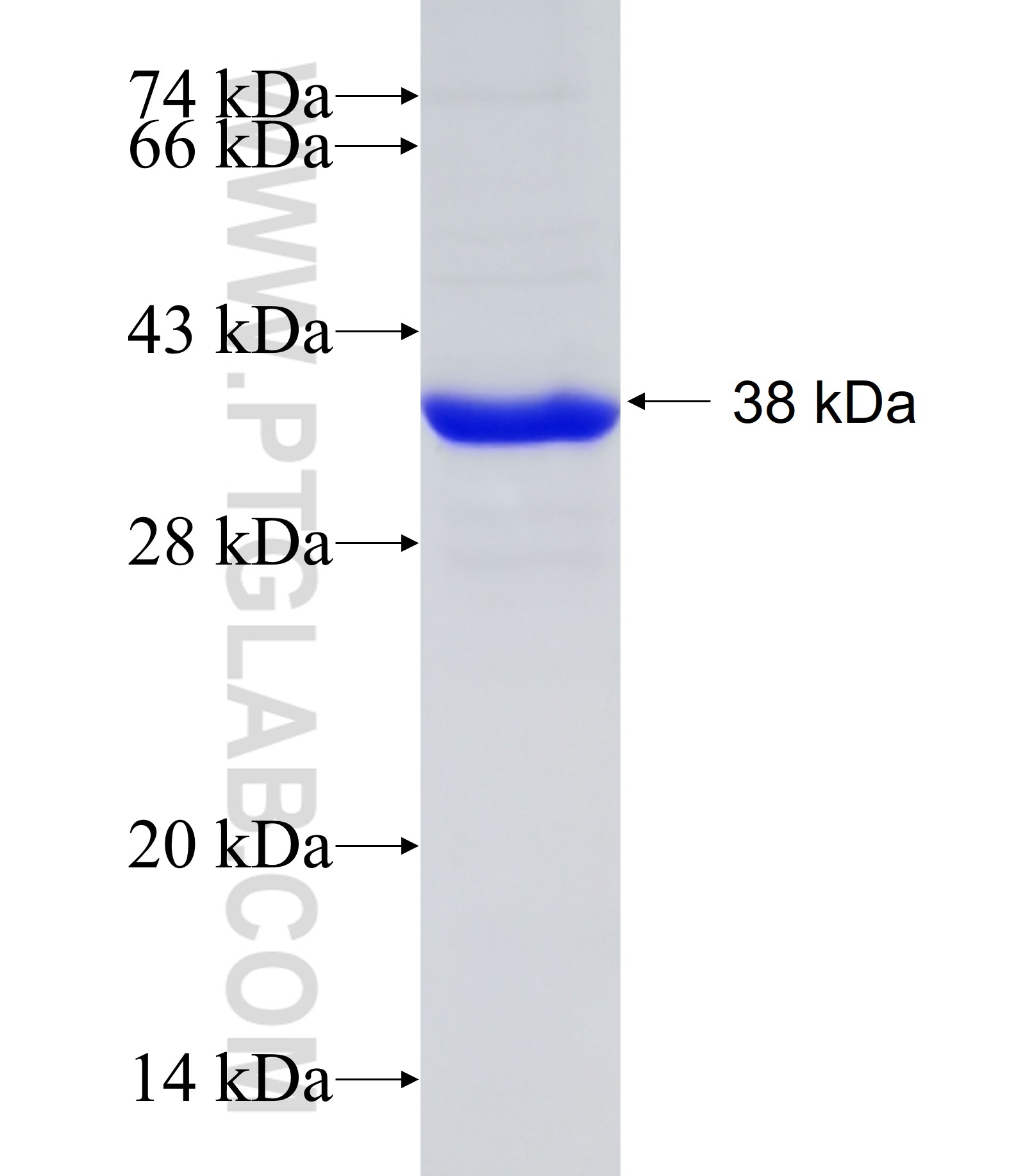 CYP7B1 fusion protein Ag19374 SDS-PAGE