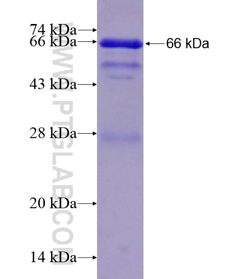 CYP7B1 fusion protein Ag19698 SDS-PAGE CYP7B1 fusion protein Ag19698 SDS-PAGE