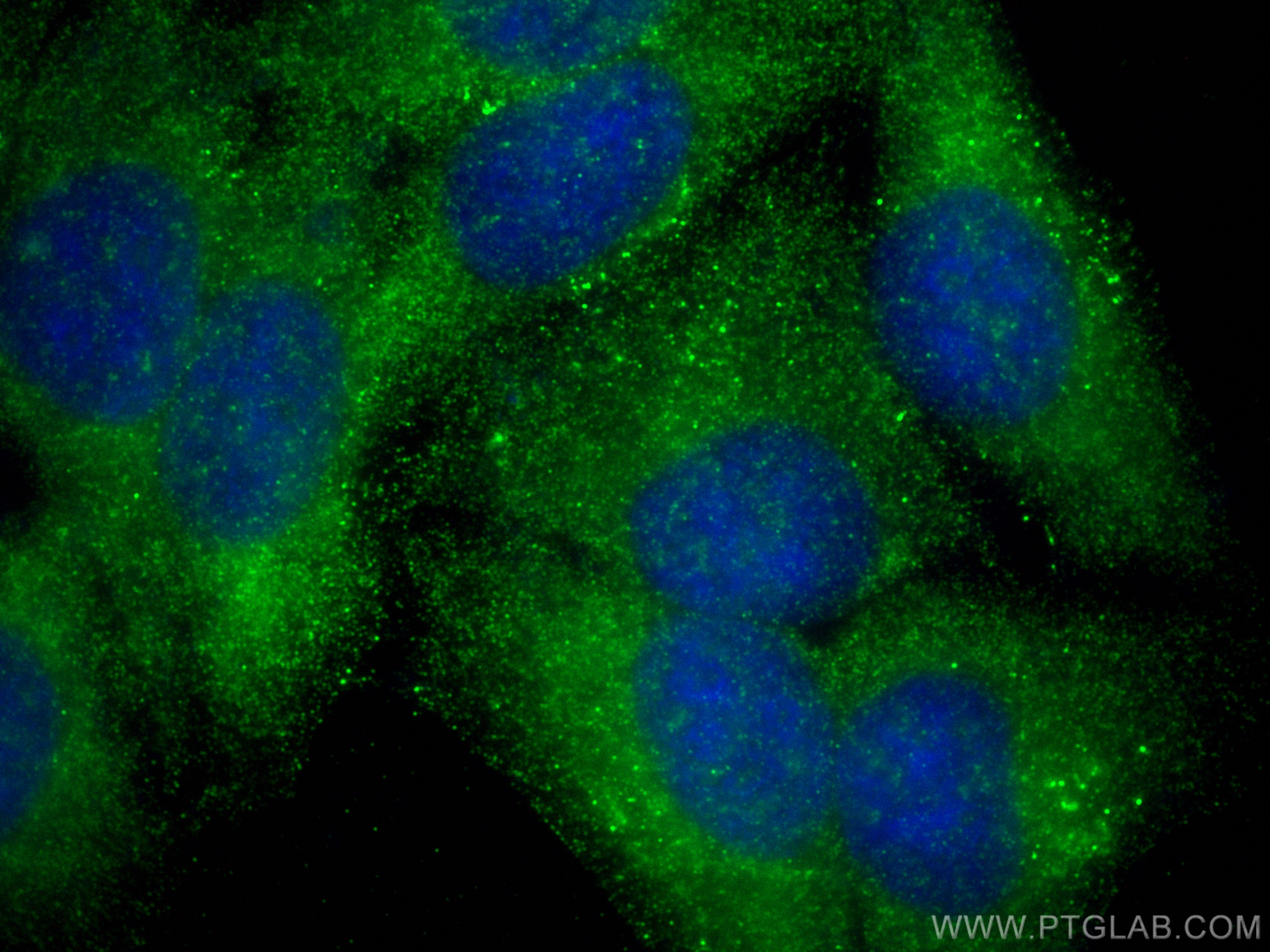 IF Staining of HepG2 using 55217-1-AP
