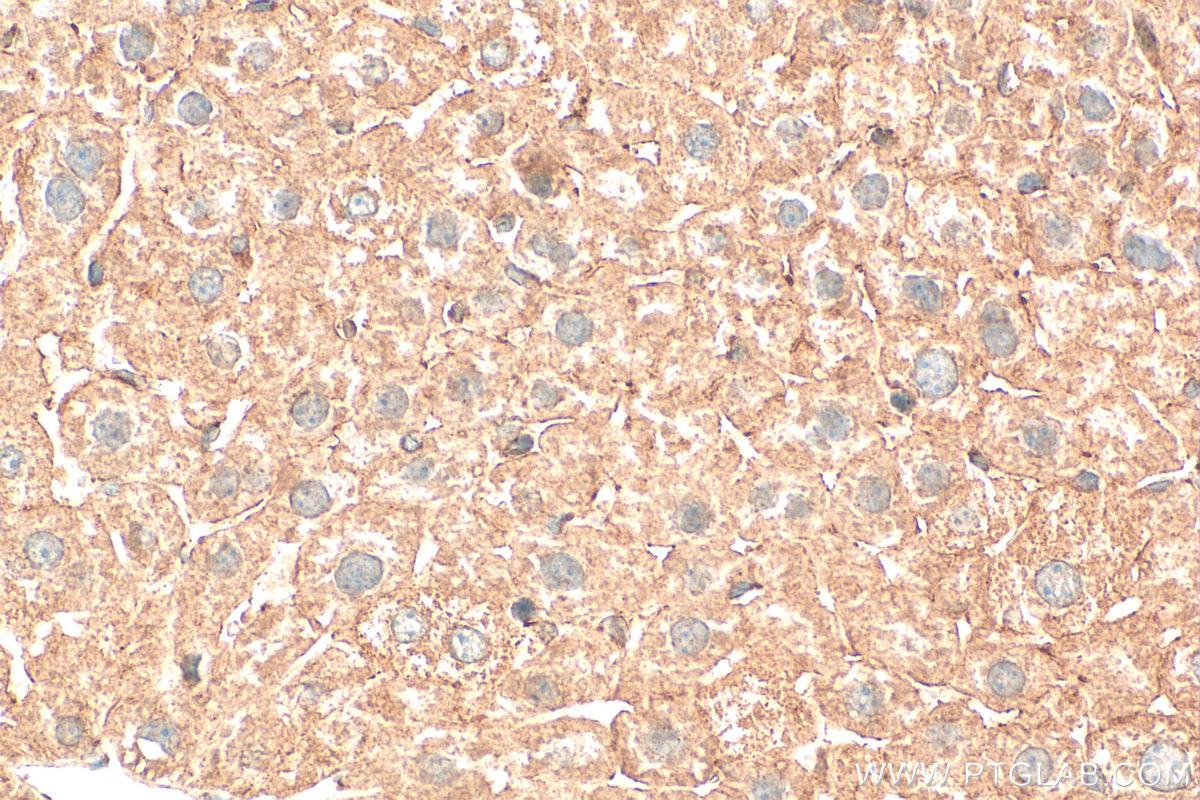 IHC staining of mouse liver using 55217-1-AP