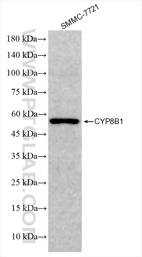 WB analysis of SMMC-7721 using 84909-1-RR