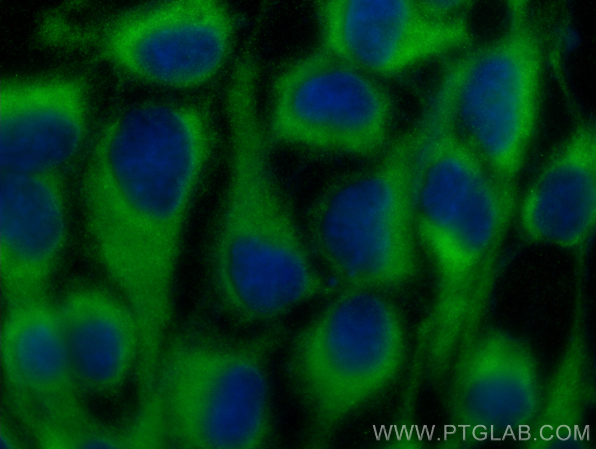 IF Staining of A431 using 26689-1-AP