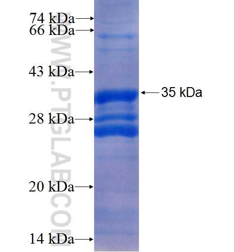 CYSLTR1 fusion protein Ag24961 SDS-PAGE