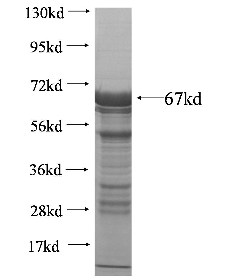 CYSLTR1 fusion protein Ag6233 SDS-PAGE CYSLTR1 fusion protein Ag6233 SDS-PAGE