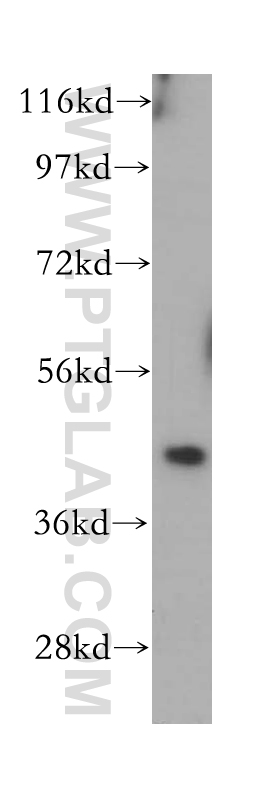 Cytohesin 1