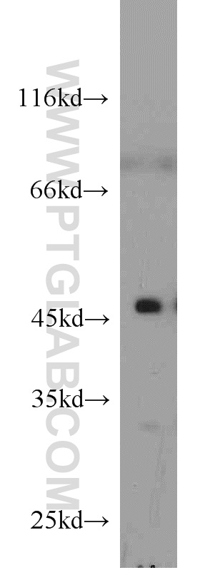 WB analysis of mouse heart using 10405-1-AP